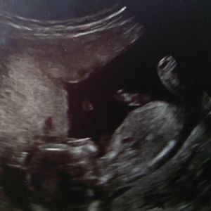 Meet your Posher, Ladystarks